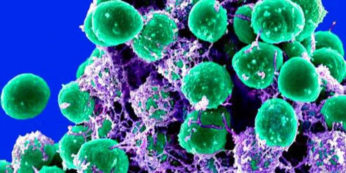 microbios